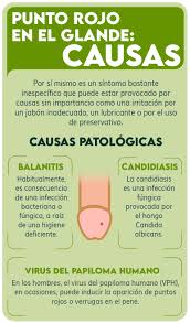 Puntos Rojos En El Glande Causas Y Tratamiento 9660 | Hot Sex Picture