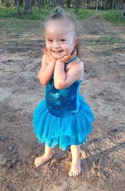 الوجوه الجميلة لمتلازمة داون صور Down Syndrome Down Syndrome Kids Beautiful Face