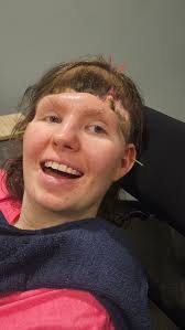 Hailees 1st acupuncture. Um, I think she likes it