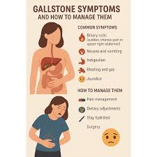 Image result for Biliary Colic