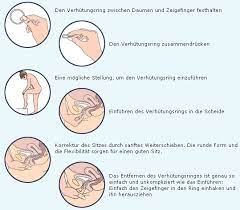 Sollte der ring versehentlich herausrutschen, kann er abgewaschen und bedenkenlos wieder eingesetzt werden. Verhutungsring Dr Med Michael Singer Gyne