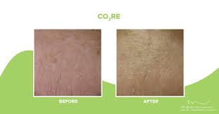 Image result for liver spots on legs