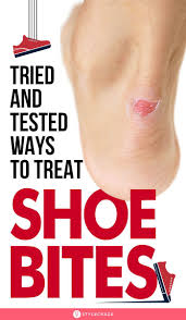 How Can I Avoid Shoe Bites In 2020 Blister Remedies Home Remedies Useful Life Hacks