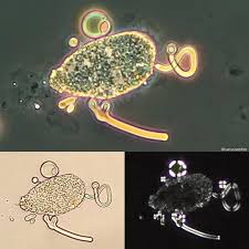 Pin On Urinaryanalysis Sediment