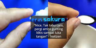 Cara menghilangkan rasa gatal pada umbi talas. Video Jari Terkena Gam Gajah Melekat Teruk Jangan Risau Ikuti Tips Ini Erin Sakura