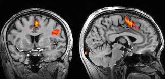 Researchers and doctors have been using it for the past 20 years to study things like during the segment, huizenga noted that while the fmri lie detector is indeed still in the experimental phase, it's much more reliable than current lie. How Is Fmri Used Nuffield Department Of Clinical Neurosciences