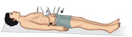Image result for Pelvic Compression Test