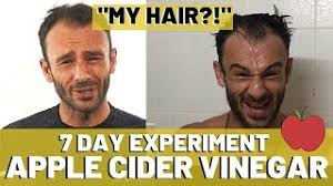 It is important that you use organic apple cider vinegar with the mother so that your apple cider vinegar lemon and rosemary rinse does not contain toxins. Apple Cider Vinegar Results For Hair Loss 7 Days Youtube