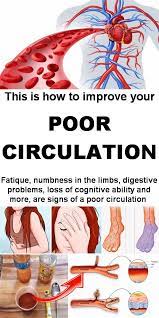 These stockings are tight around your. Pin On Home Remedies