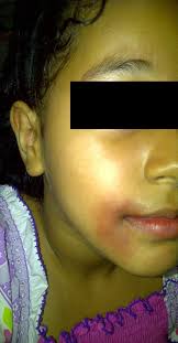 VIOLENCIA ESCOLAR: 2015