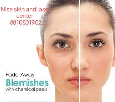 Nisa skin and hair clinic, dr sharique Ali