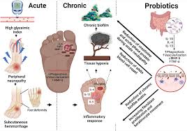 Image result for IDSA Diabetic Foot Wound Classification