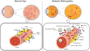 Salvador lies on a small, roughly triangular peninsula that separates the bay of all saints, the largest bay in brazil, from the atlantic ocean. Role Of Pericytes In The Retina Eye
