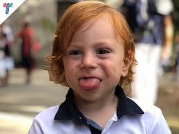 Questo dolcissimo bambino dai capelli rossi si chiama Ellis. Ha 3 anni e  affronta, dal momento in cui è venuto al mondo, i sintomi che porta con sé  la sindrome di Beckwith-Wiedemann.