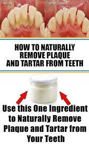 Pin On Oral Care