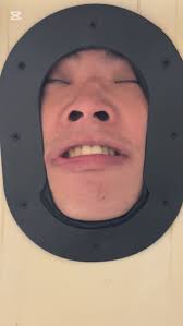 估唔到首次接觸收縮水係睇physio😂