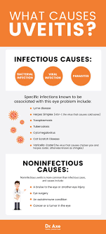 Uveitis 7 Natural Ways To Improve Symptoms Dr Axe Uveitis Eye Health Cold Sore