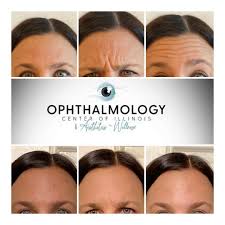 Concierge aesthetics, top rated medspa irvine (orange county). Botox Near Me Springfield Il Dysport Near Me