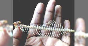 What You Should Immediately Eat When A Fish Bone Gets Stuck In Your Throat Fish Bone Filet Of Fish Throat Remedies