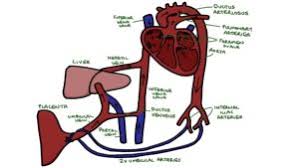 Image result for Delayed Transition from Fetal Circulation