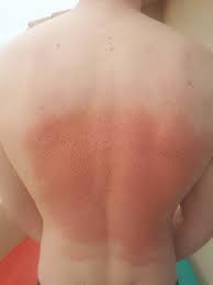 Je veux pas aller chez un medecin, trop la honte ! Champ De Fleurs Une Solution Pour Vos Problemes Avis D Un Osteopathe