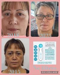 Ageless Face Wand and Eye Wand Review and Results