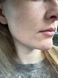 Farmasi Dr. C Tuna Acne Cleanser review