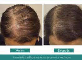Hair loss caused by hormonal changes, like pregnancy or menopause, or stress may not require any treatment. Updates Cures For Hair Loss 2021 Follicle Thought