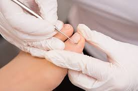 I've heard of curves to the left and right but i haven't read about a downward curve. Curved Toenails Causes Symptoms And Treatments