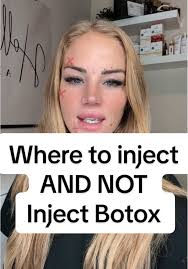 Essential Guidelines for Safe Botox Injection Areas