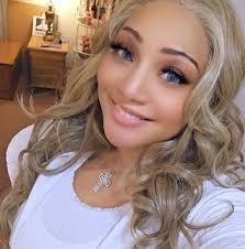 If your eyes are healthy, what animal is in this picture?