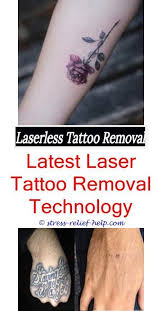 Anyone who tells you that tattoo removal is pain free is lying to you. Is Laser Tattoo Removal Safe Is There A Way To Remove Tattoos How Much Does Getting A Tattoo Removed Cost Easy Tatto Falsche Tattoos Tatowierungen Tatowieren