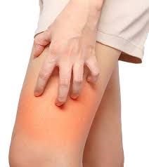 How To Get Rid Of Boils On Inner Thigh Naturally