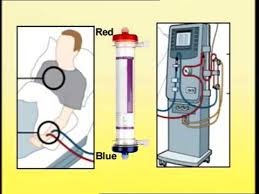 Page 4 2008t technician's manual, p/n 490130 contact fresenius medical care technical support for applicable field service bulletins. Setting Up Of Dialysis Machine Youtube