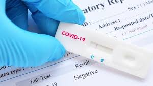 Kimia Farma Impor Ribuan Rapid Tes Dari Belanda Ketua Gugus Tugas Covid 19 Doni Akurasi Rendah