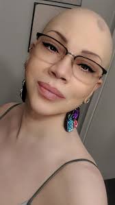 My wife went out with me for the first time without a wig. She was  diagnosed with scaring alopecia years before I met her. I remember the  first time she showed me