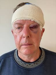 Coulton's wake-up call