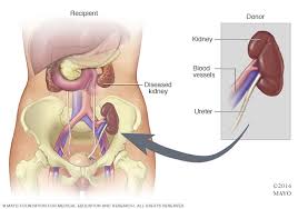 Https Www Stclair Org Services Mayo Clinic Health Information Tests And Procedures Prc 20196294