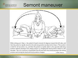 Won't you stay a little longer? Practice Parameter Therapies For Benign Paroxysmal Positional Vertigo An Evidence Based Review Report Of The Quality Standards Subcommittee Of The American Ppt Download