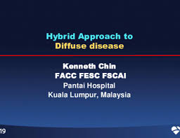 Coronary artery disease in rheumatoid arthritis: Case 5 From Malaysia Hybrid Approach In Diffuse Coronary Artery Disease Tctmd Com