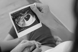 Image result for First Obstetric Visit