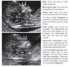 Pin On Ob Risk Factors 1st Trimester