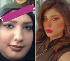 عمليات التجميل في تركيا تشهد تطوراً واسعاً، بتقنيات علمية متطورة، على أيدي خبراء أكفاء هدفهم إحياء الجمال، وترميم المتعب منه، النجاح تمتد عمليات التجميل لتشمل في تقنياتها الرجال، يستطيع الرجل الحصول على شكل مثالي، كشد الوجه ونحت الخصر، وزراعة الشعر. Ù…Ø±ÙˆÙ‡ Ø±Ø§ØªØ¨ Ù‚Ø¨Ù„ Ø¹Ù…Ù„ÙŠØ§Øª Ø§Ù„ØªØ¬Ù…ÙŠÙ„