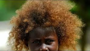Black hair is the darkest and most common of all human hair colors globally, due to larger populations with this dominant trait. Can Black People Have Red Hair Quora