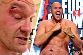 Anthony Joshua vs Francis Ngannou: UFC star grabs spotlight from Tyson Fury