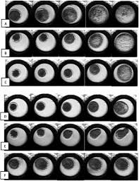 Maybe you would like to learn more about one of these? Cryopreservation Of Donkey Embryos Comparison Of Embryo Survival Rate After In Vitro Culture Between Conventional Freezing And Vitrification Sciencedirect