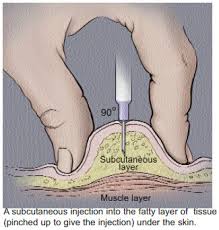 Image result for Subcutaneous Injection