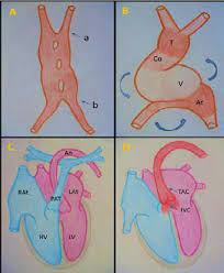 Pdf Truncus Arteriosus Communis Report Of Three Cases And Review Of Literature Semantic Scholar