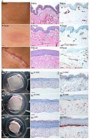 Hould i be worried about big holes in my skin like this? Macroscopic And Microscopic Comparison Of Healthy Skin With Scar Tissue Download Scientific Diagram