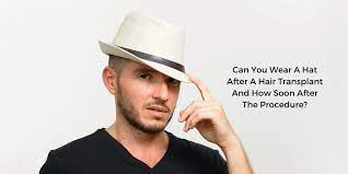 Can You Wear A Hat After A Hair Transplant And How Soon After The Procedure